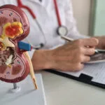 Why Getting a Kidney Ultrasound Early Could Save You From Bigger Health Problems Later