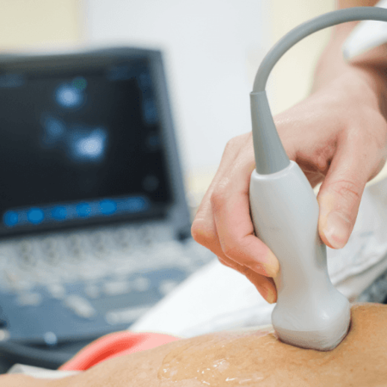The Truth About Heart Ultrasounds